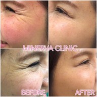 Minerva Clinic สยามพารากอน
