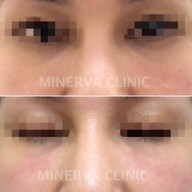 Minerva Clinic สยามพารากอน