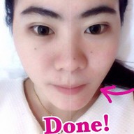 Minerva Clinic สยามพารากอน