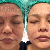 Minerva Clinic สยามพารากอน