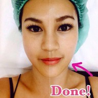 Minerva Clinic สยามพารากอน