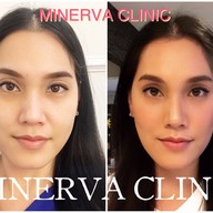 Minerva Clinic สยามพารากอน