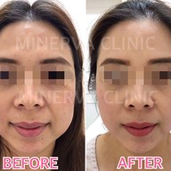 Minerva Clinic สยามพารากอน