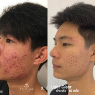 เมนูของร้าน ATTITUDE CLINIC เชียงราย