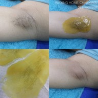 Waxing Home Chiangmai แว็กซ์ขนเชียงใหม่ที่หนึ่งเรื่องบิกินี่แว็กซ์