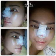 Blink Clinic by Dr.Mai สุขุมวิท 23