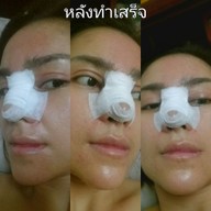 Blink Clinic by Dr.Mai สุขุมวิท 23