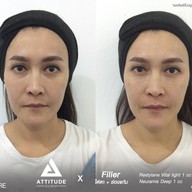 เมนูของร้าน ATTITUDE CLINIC เชียงราย