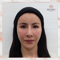 Amarante Clinic บางนา : For You Park