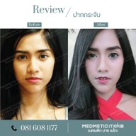 Medmetic By Meko เมดเมติก บาย เมโกะ