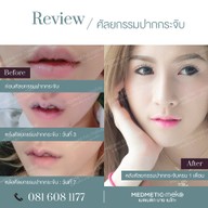 Medmetic By Meko เมดเมติก บาย เมโกะ