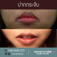 Medmetic By Meko เมดเมติก บาย เมโกะ