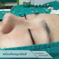 เมนูของร้าน T-point clinic เสริมจมูก แก้จมูก ตัดปิกจมูก เสริมคาง พิษณุโลก