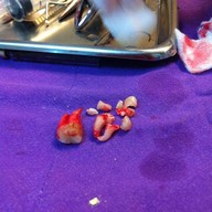 ศาลาแดง ซ.1 ทันตกรรม (SDC1st Dentist)