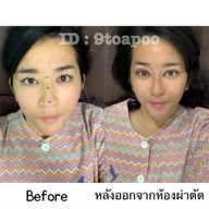 View Plastic Surgery Seoul,South Korea
