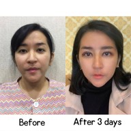 View Plastic Surgery Seoul,South Korea
