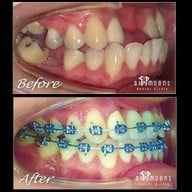Siamdent Dental Clinic จรัญสนิทวงศ์