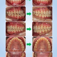 Siamdent Dental Clinic จรัญสนิทวงศ์