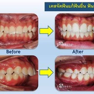 Siamdent Dental Clinic จรัญสนิทวงศ์