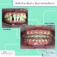 Siamdent Dental Clinic จรัญสนิทวงศ์