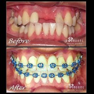 Siamdent Dental Clinic จรัญสนิทวงศ์