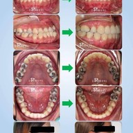 Siamdent Dental Clinic จรัญสนิทวงศ์