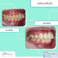 Siamdent Dental Clinic จรัญสนิทวงศ์