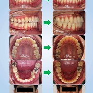 Siamdent Dental Clinic จรัญสนิทวงศ์