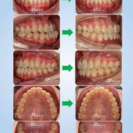 Siamdent Dental Clinic จรัญสนิทวงศ์
