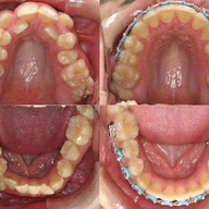 Siamdent Dental Clinic จรัญสนิทวงศ์