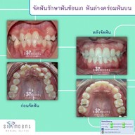 Siamdent Dental Clinic จรัญสนิทวงศ์