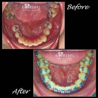 Siamdent Dental Clinic จรัญสนิทวงศ์