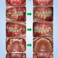 Siamdent Dental Clinic จรัญสนิทวงศ์