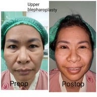 จุฑามาศ คลินิก เอ็มบีเค