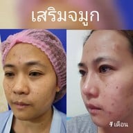 จุฑามาศ คลินิก เอ็มบีเค