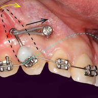 เมนูของร้าน ศาลาแดง ซ.1 ทันตกรรม (SDC1st Dentist)