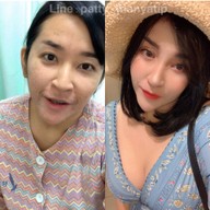 View Plastic Surgery Seoul,South Korea