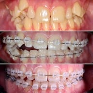 ศาลาแดง ซ.1 ทันตกรรม (SDC1st Dentist)