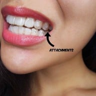 ศาลาแดง ซ.1 ทันตกรรม (SDC1st Dentist)