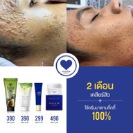 พี่กุ้งกดสิว มาดามกิ๊กกี้ by พี่ขวัญ สาขาจังหวัดลำพูน