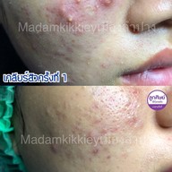 มาดามกิ๊กกี้ สาขาอำเภอเมืองลำปาง