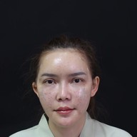 P10 Clinic ( Surgery Cosmetic ) เมเจอร์รัชโยธิน