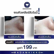 มาดามกิ๊กกี้ พี่กุ้งกดสิว สาขาเมืองเพชรบูรณ์ เมืองเพชรบูรณ์