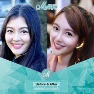 เมนูของร้าน มชิตาคลินิก  เชียงใหม่