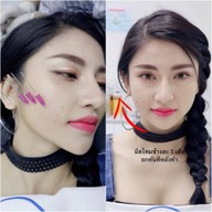 เมนูของร้าน VC Clinic วีซีคลินิก รัชดา