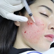 เมนูของร้าน VC Clinic วีซีคลินิก รัชดา