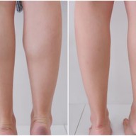 เมนูของร้าน VC Clinic วีซีคลินิก รัชดา