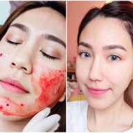 เมนูของร้าน VC Clinic วีซีคลินิก รัชดา