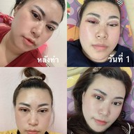 มชิตาคลินิก  เชียงใหม่