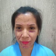 P10 Clinic ( Surgery Cosmetic ) เมเจอร์รัชโยธิน